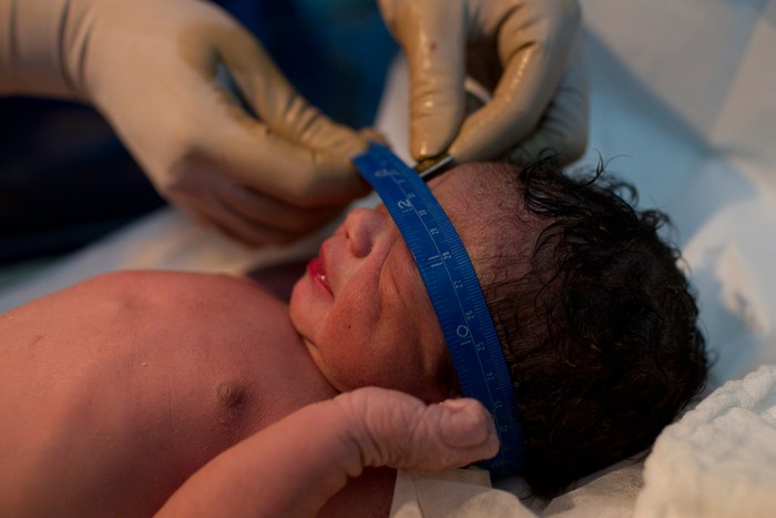 Cân đo cho một cháu bé sơ sinh ở bệnh viện công Santa Ana, Caracas, Venezuela.